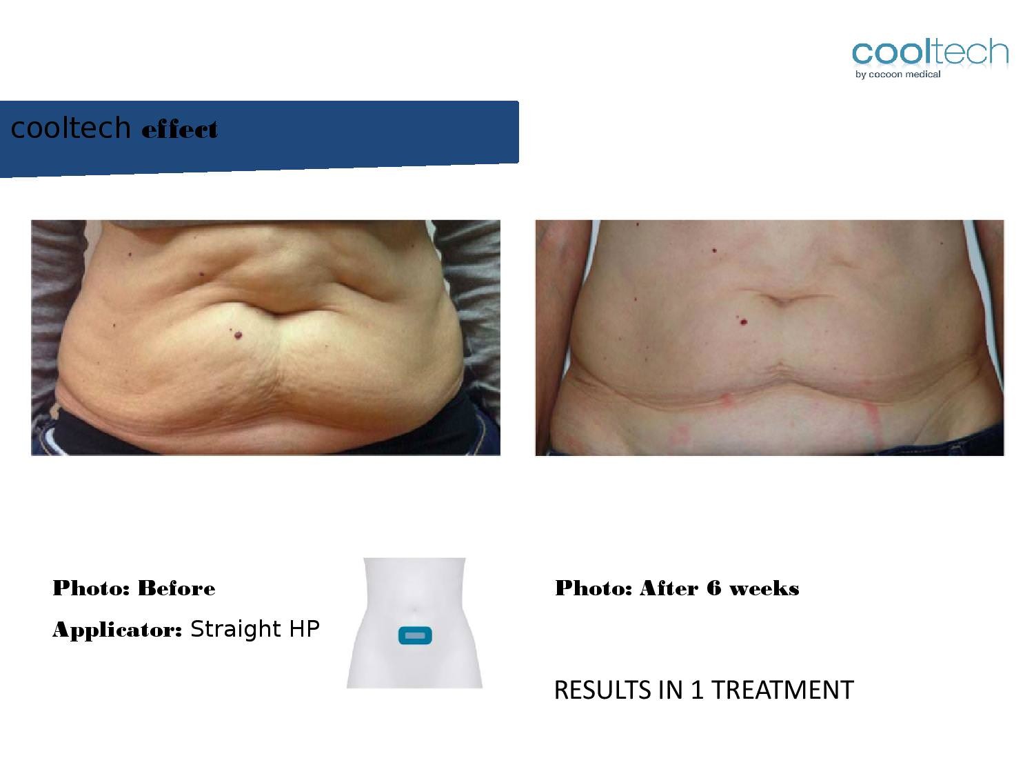 Presentation Cooltech ENG Wigmore Days Novaaaa1-page-013